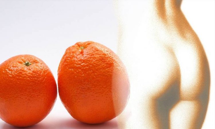 cellulite e buccia arancia